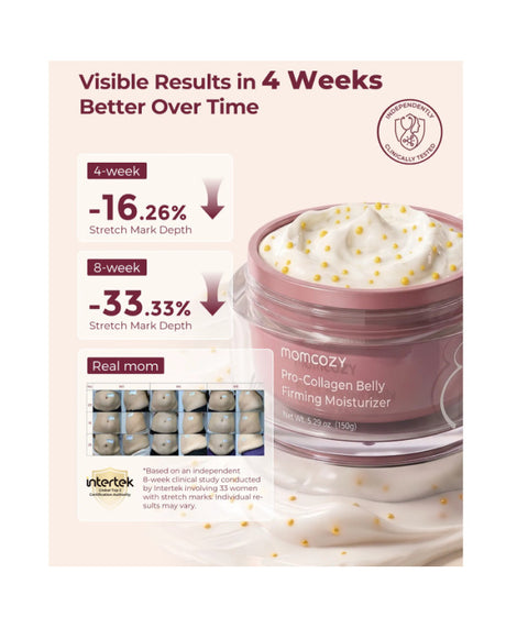 Momcozy stangrinamasis kūno kremas nuo strijų su kolagenu, 30 g