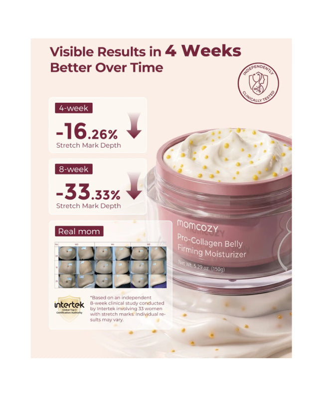 Momcozy stangrinamasis kūno kremas nuo strijų su kolagenu, 30 g